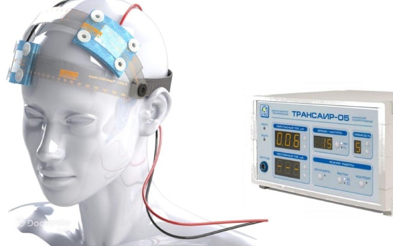 آیا انقلابی در درمان افسردگی: آیا دستگاه TDCS می‌تواند جان شما را نجات دهد؟