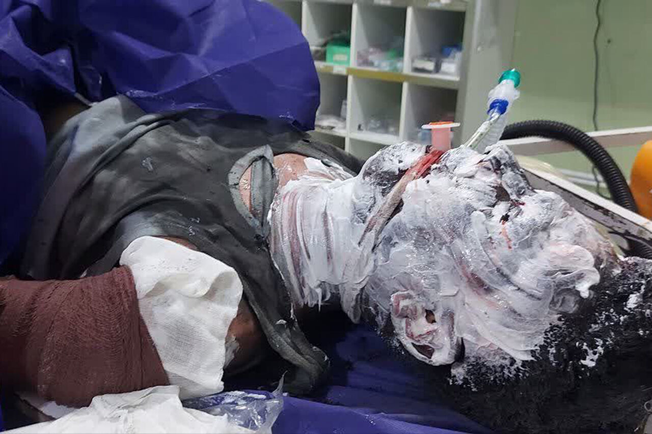 «چهارشنبه‌سوری به کشتارگاه تبدیل شد؛ ۲۱ جان باخته و ۶۴۱۹ زخمی، افزایش وحشتناک ۲۳ درصدی آسیب‌ها نسبت به سال گذشته!»